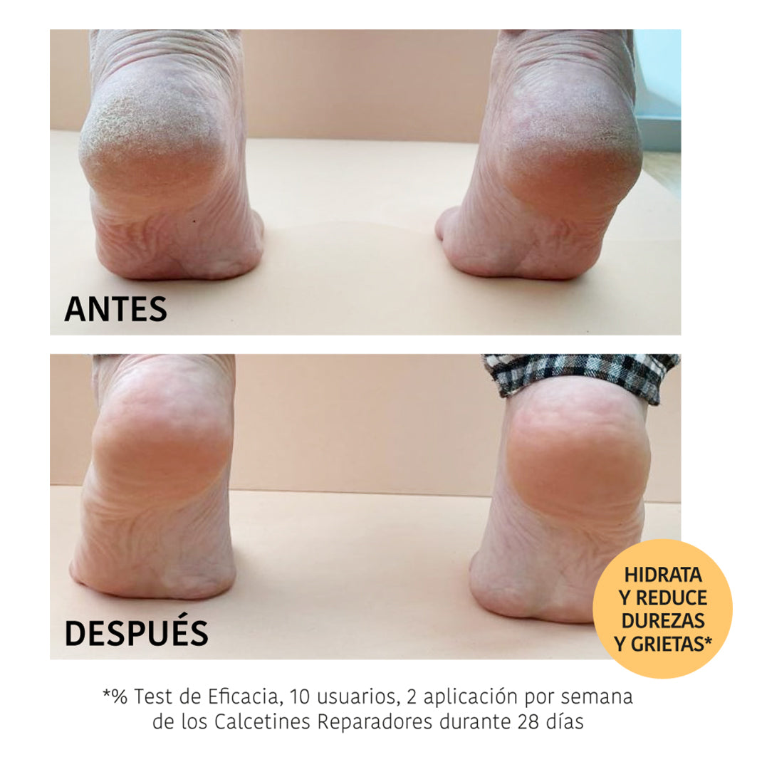 Repair Peach Foot Mask