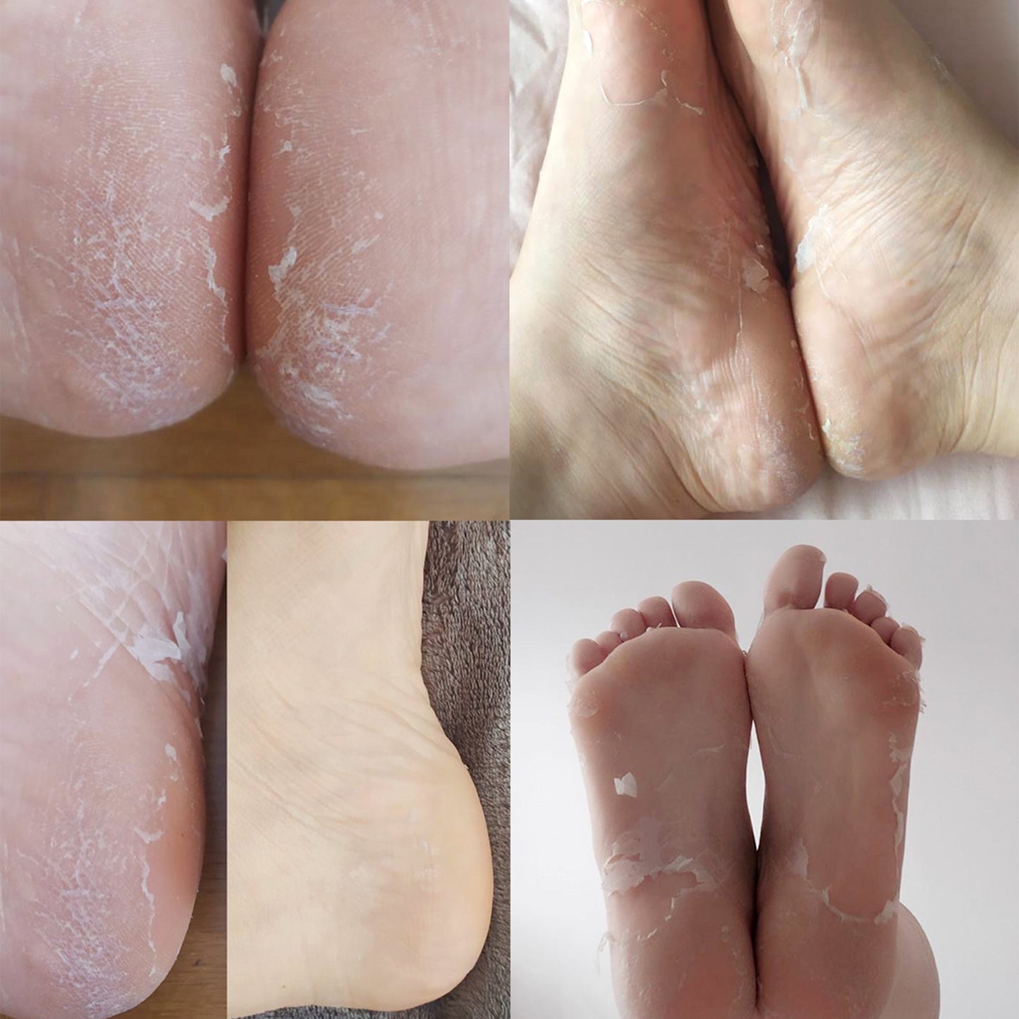 Calcetines Peeling y Exfoliantes Ácido Glicólico