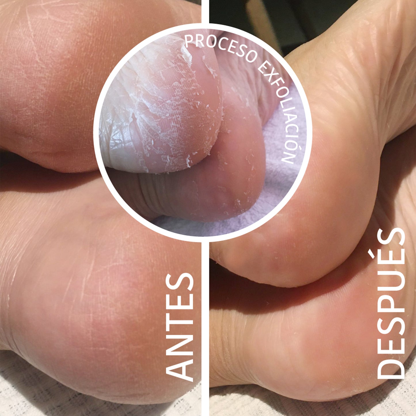 Calcetines Peeling y Exfoliantes Ácido Glicólico