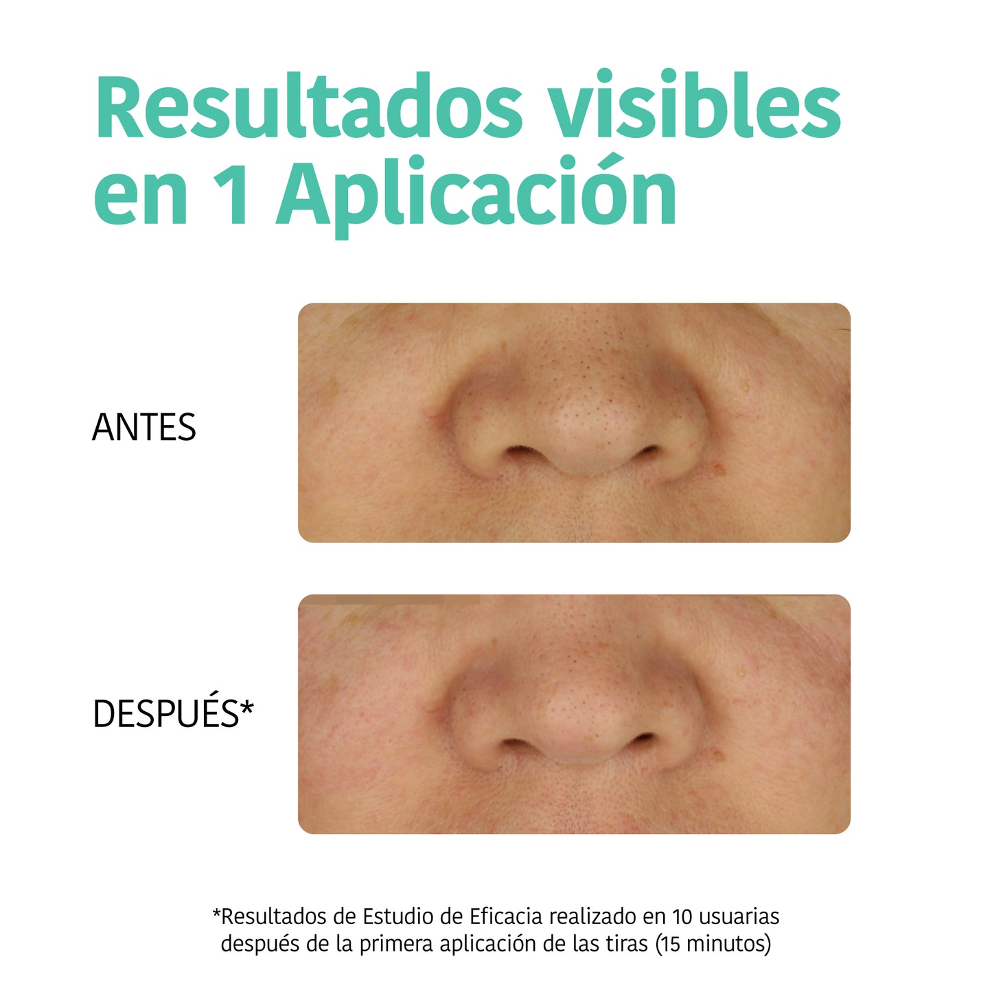 Deep Pore Cleansing Nose Strips with Charcoal