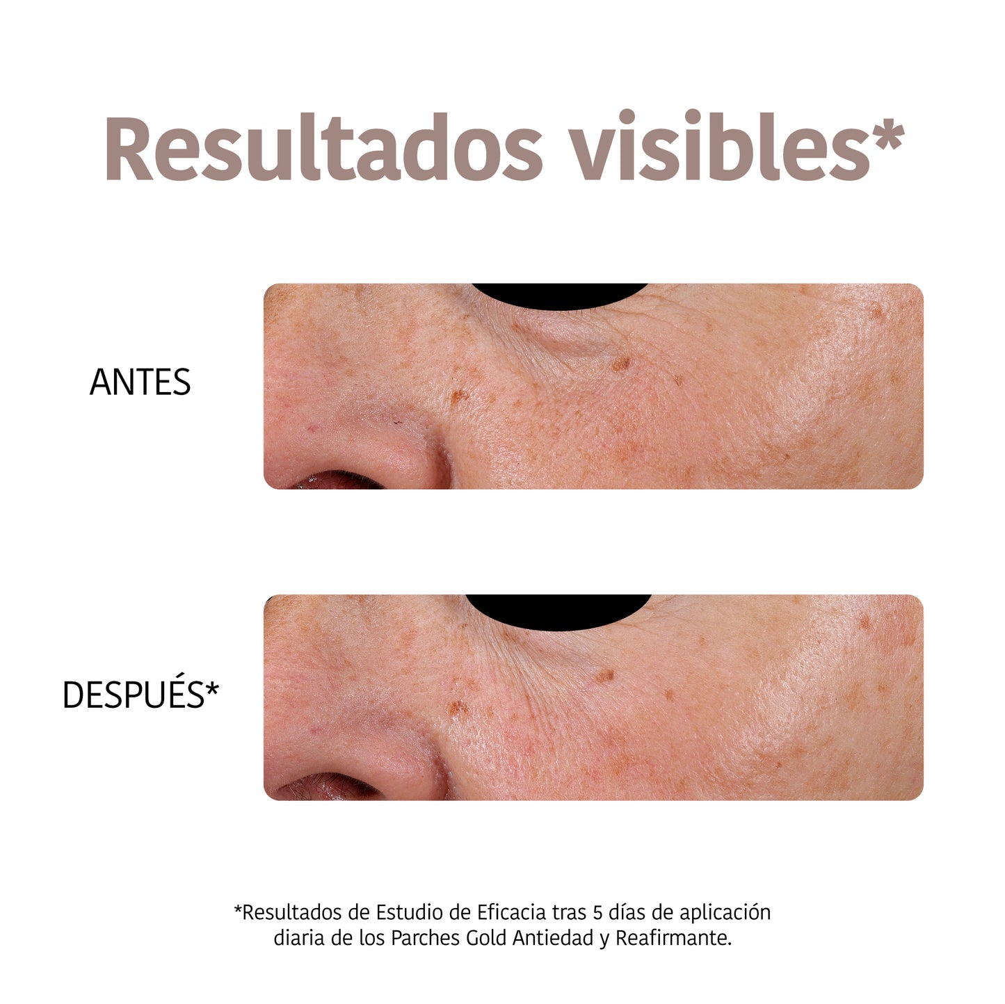 Anti-Aging Eye Patches with Gold & Peptides