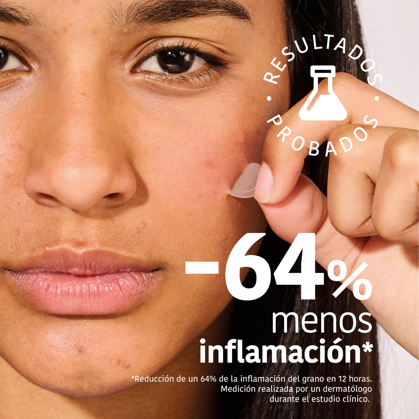 Microdarts Pimple Patches with Salicylic Acid