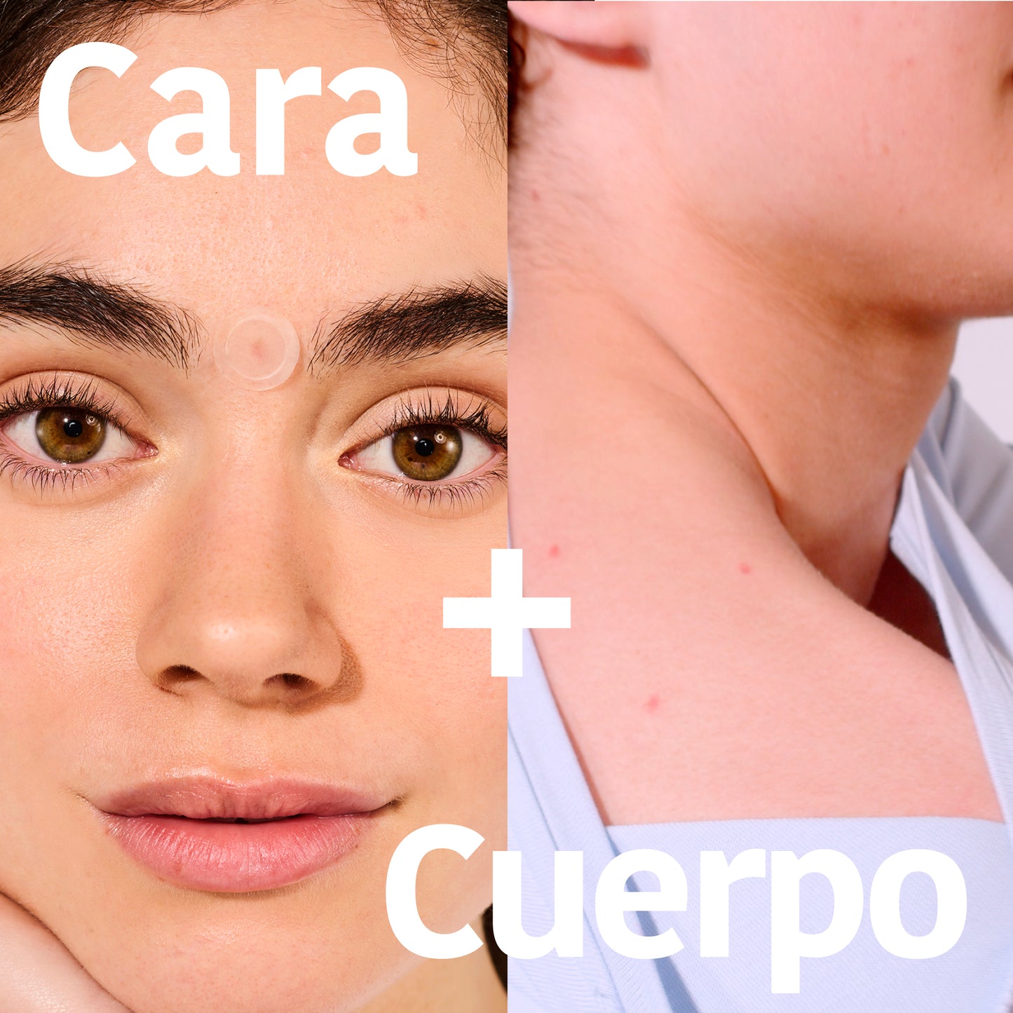 Microdarts Pimple Patches with Salicylic Acid