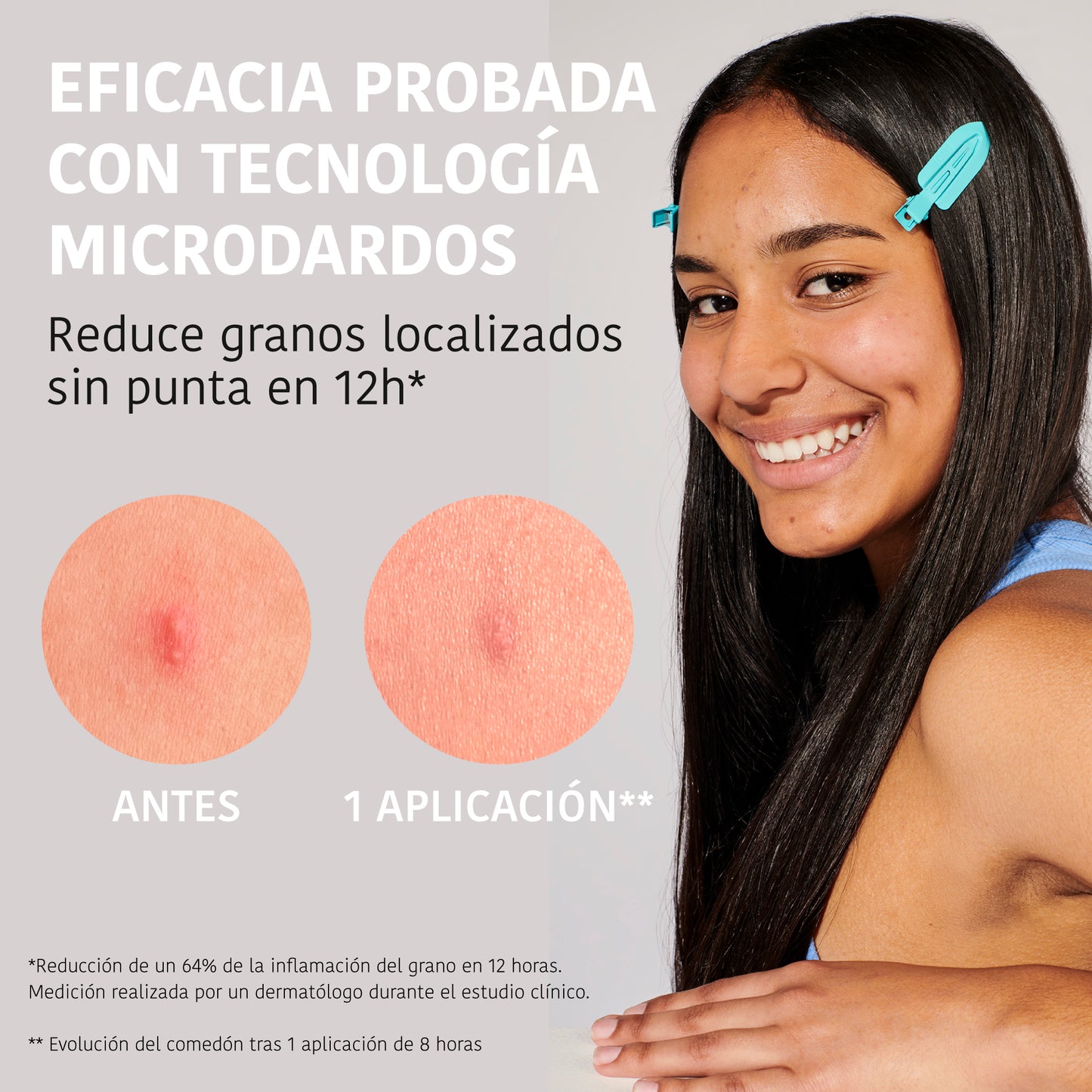 Microdarts Pimple Patches with Salicylic Acid