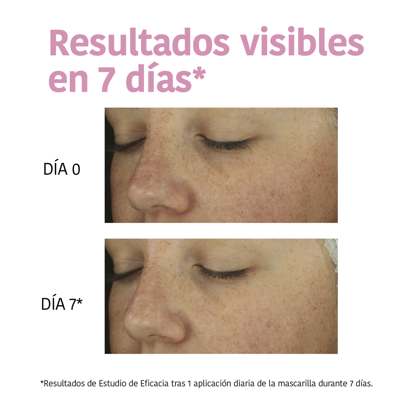 Barrier Repair Mask with Ceramides