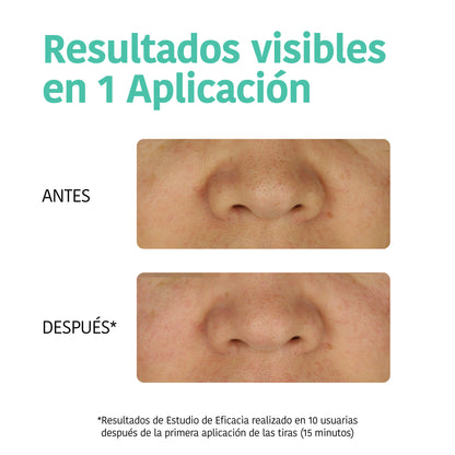 Deep Pore Cleansing Nose Strips with Charcoal