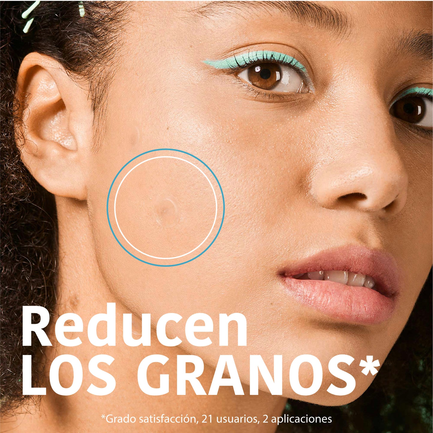 SOS Pimple Patches with Salicylic Acid