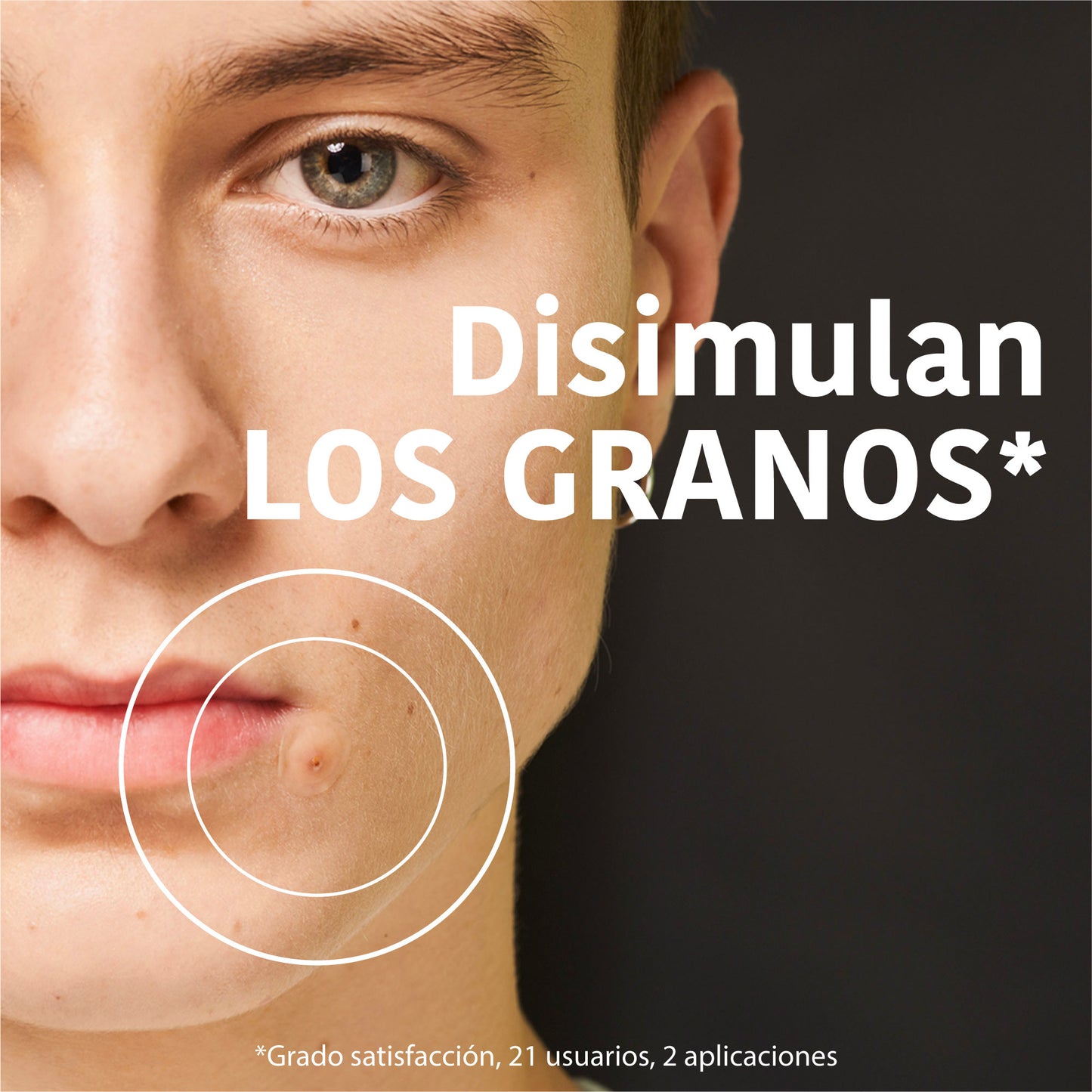 SOS Pimple Patches with Salicylic Acid