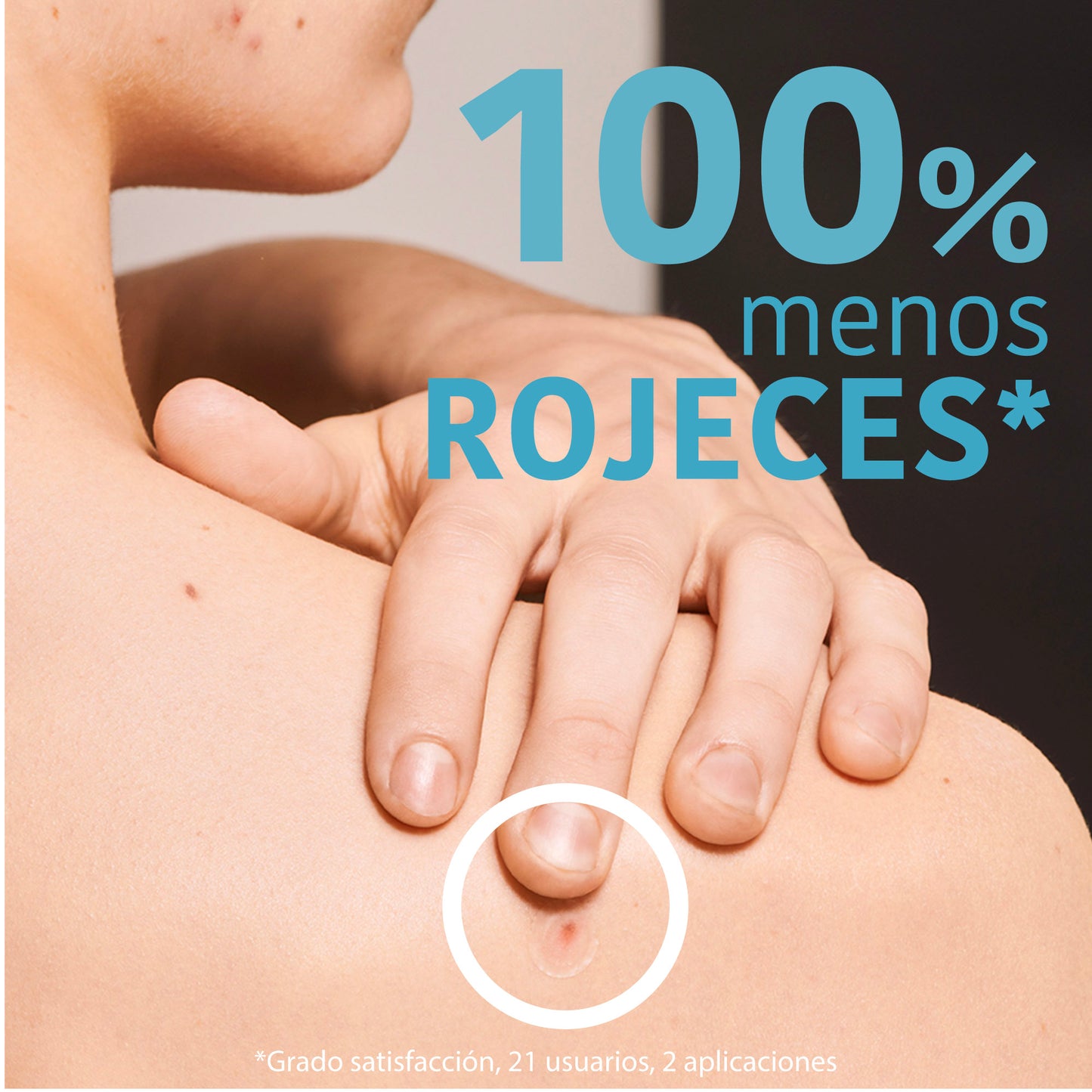 SOS Pimple Patches with Salicylic Acid