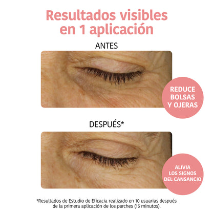 Anti-fatigue and Illuminating Eye Contour Patches with Vitamin C