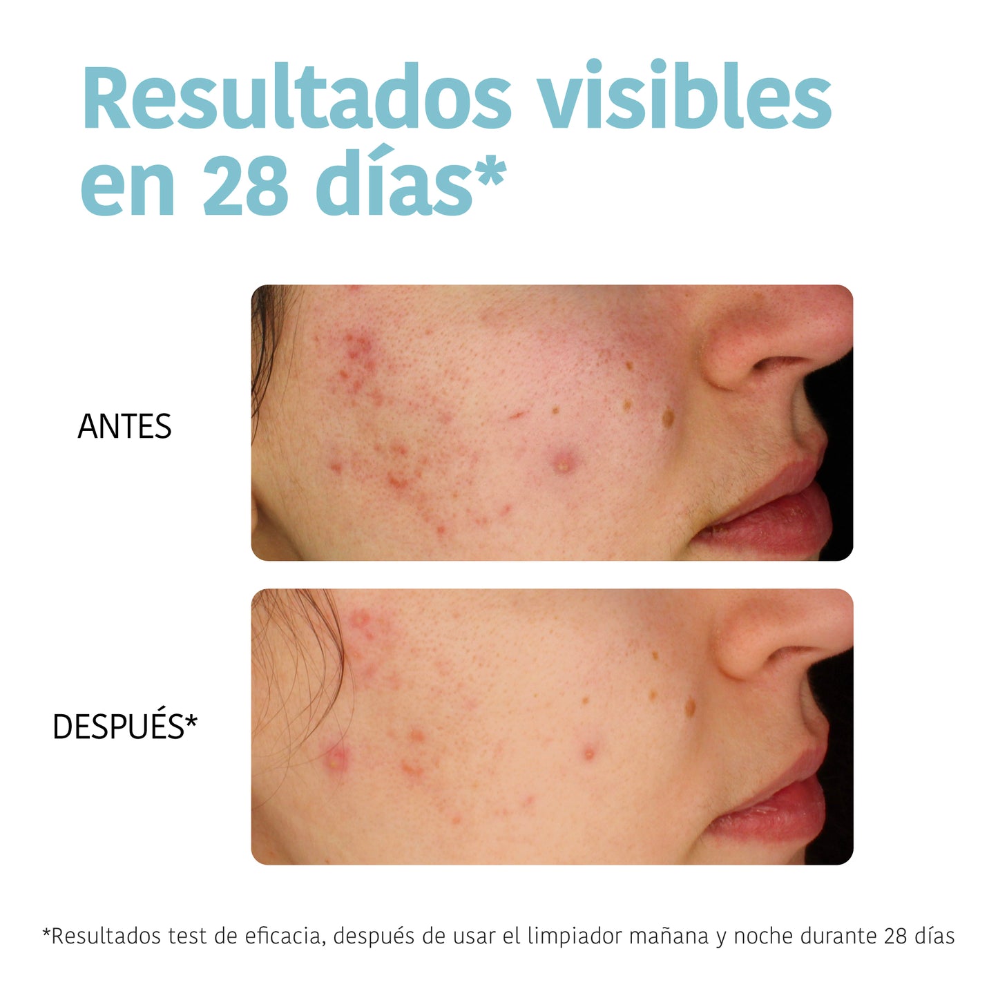 Purifying Anti-Blemish Cleansing Gel