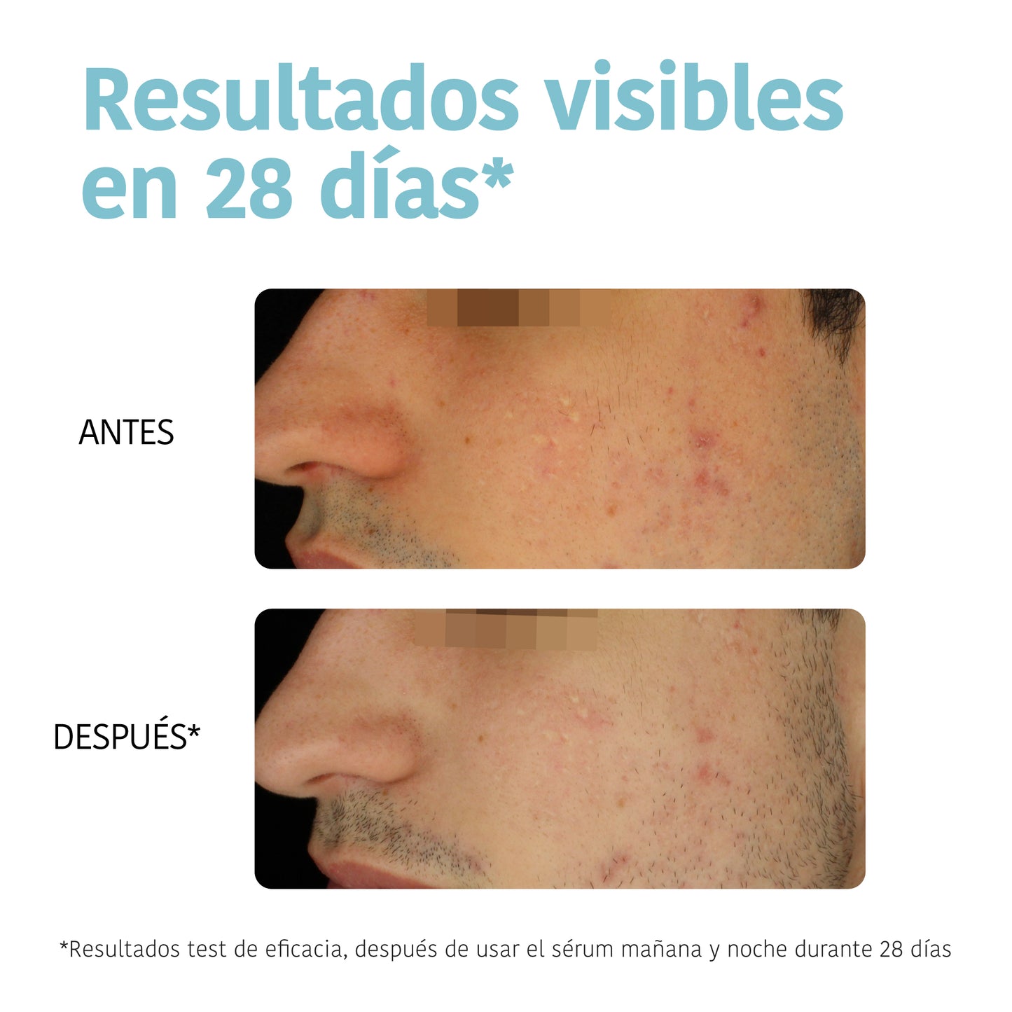 Prevent & Correct Anti-Blemish Serum