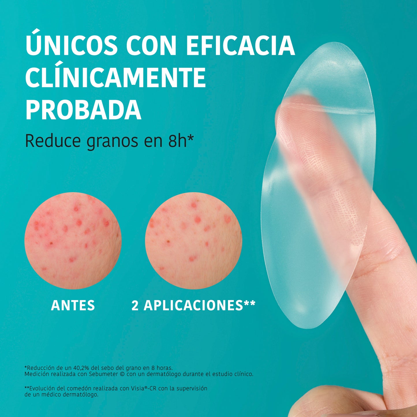 XL Pimple Patches with Salicylic Acid