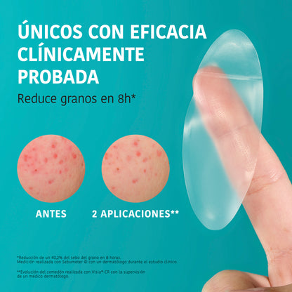 XL Pimple Patches with Salicylic Acid