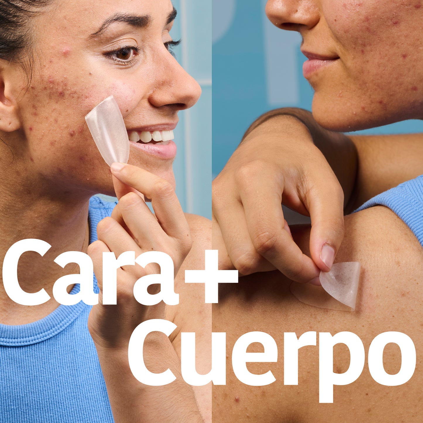 XL Pimple Patches with Salicylic Acid