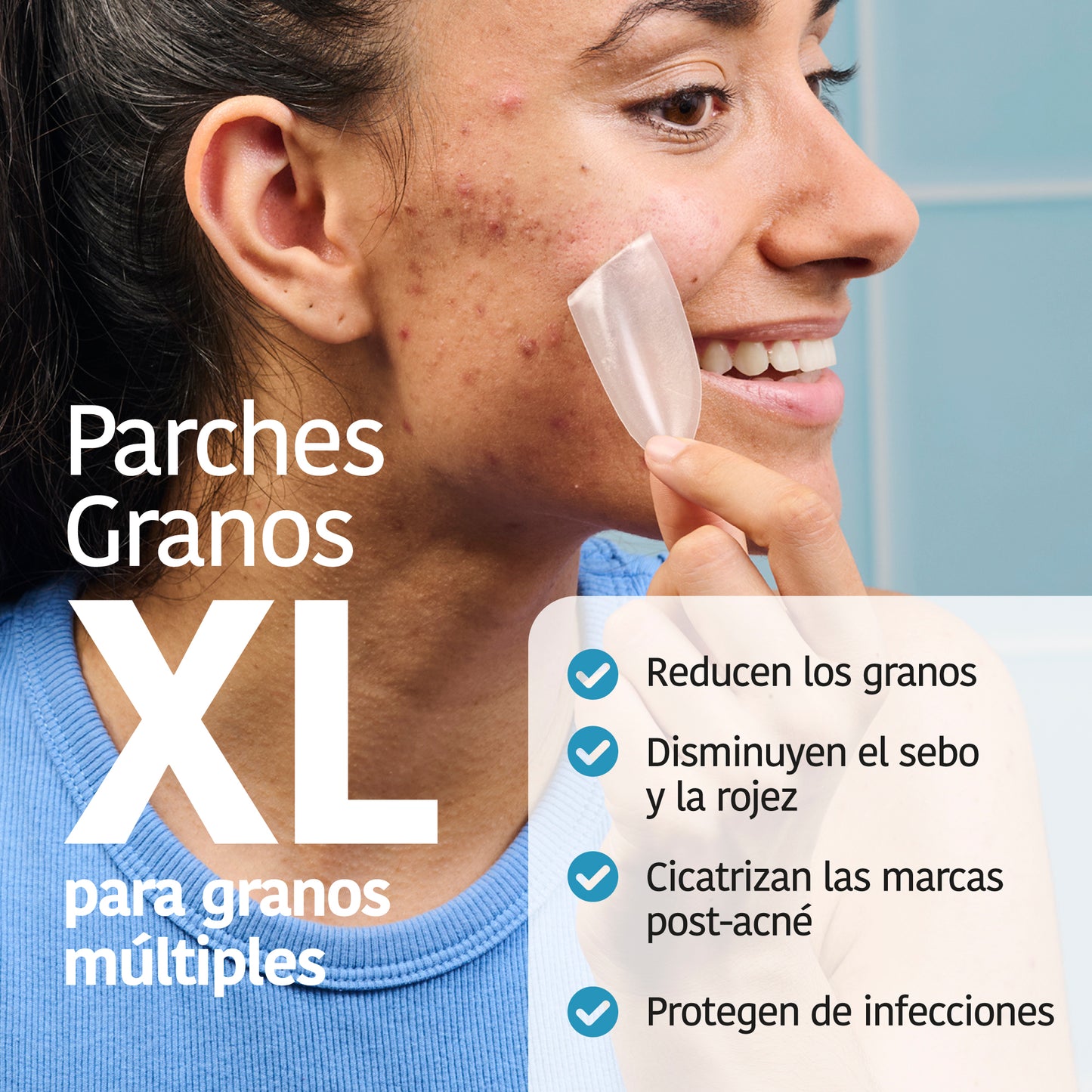 XL Pimple Patches with Salicylic Acid