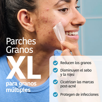 XL Pimple Patches with Salicylic Acid