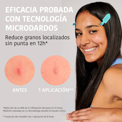 Microdarts Pimple Patches with Salicylic Acid