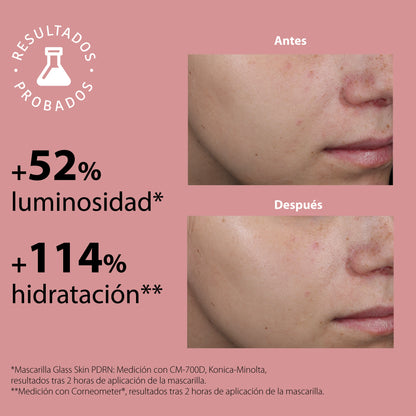 Glass Skin Hydrogel Brightening Mask with PDRN
