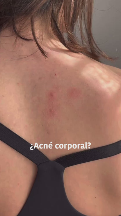 XL Pimple Patches with Salicylic Acid